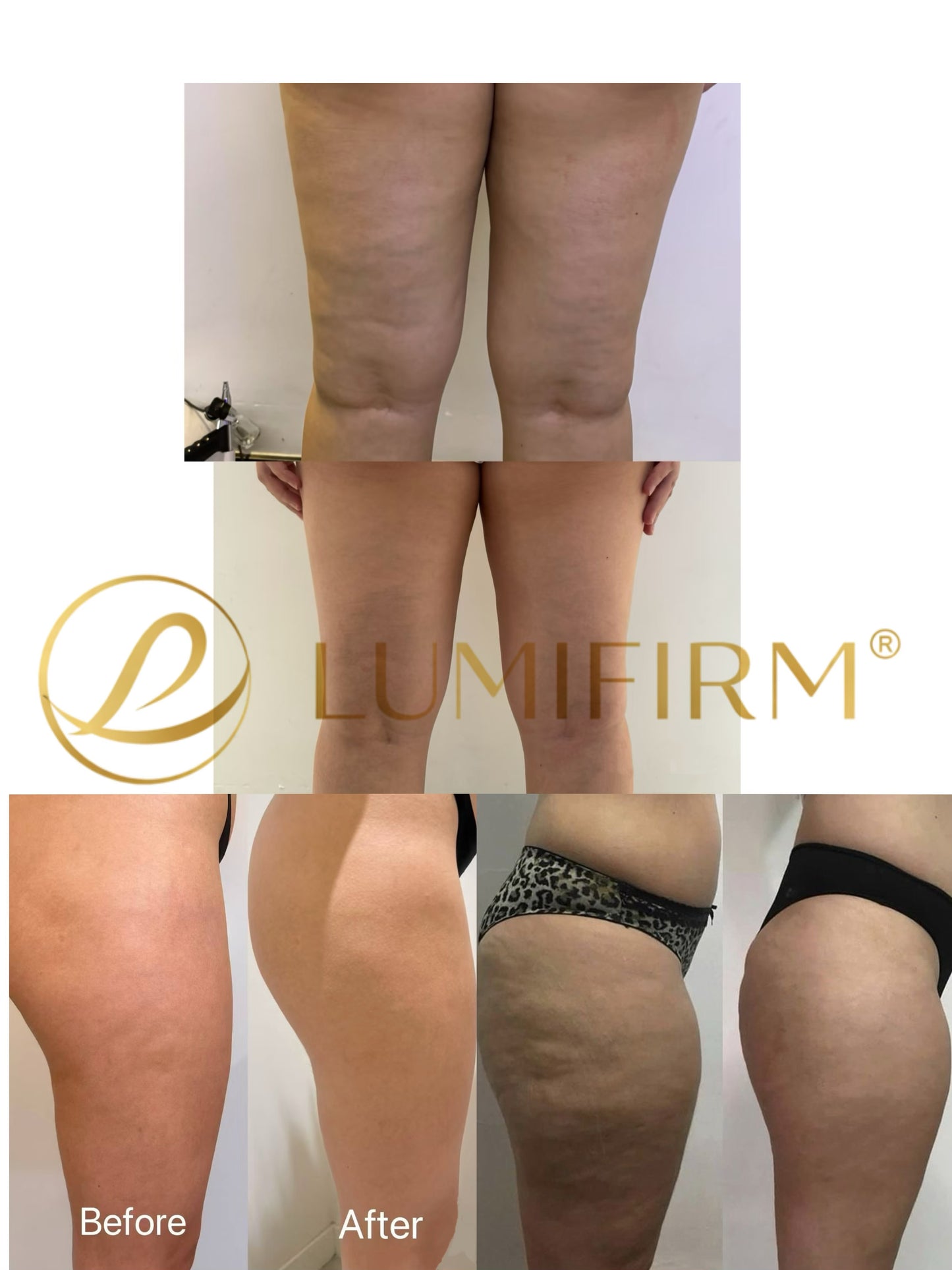 LUMIFIRM® – Firmer, More Toned Skin