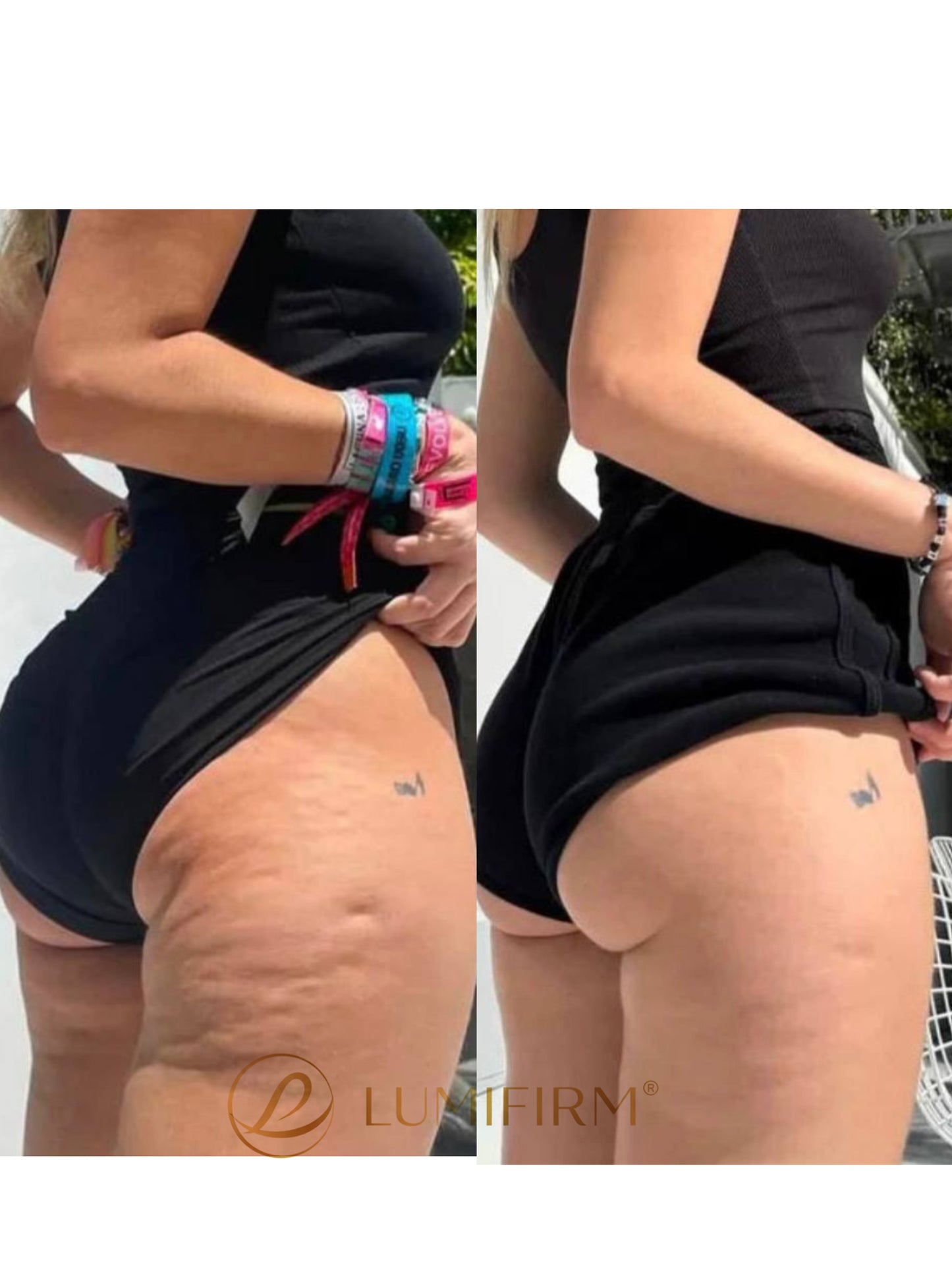 LUMIFIRM® – Firmer, More Toned Skin