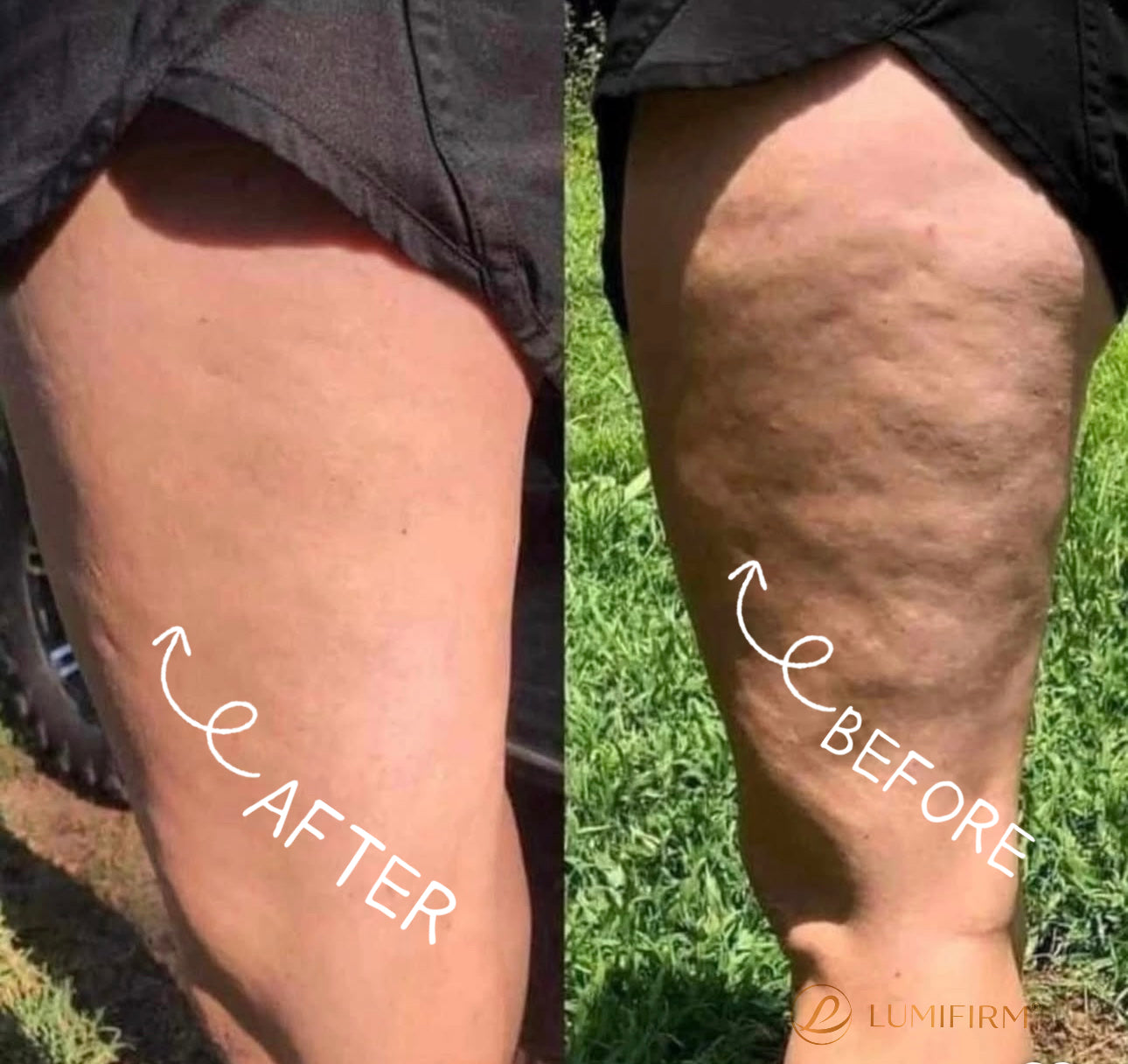 LUMIFIRM® – Firmer, More Toned Skin